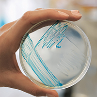 Mikrobielle Lebensmittelsicherheit und -qualität: Wie werden sie beurteilt?